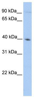 WB Suggested Anti-ODF2 Antibody Titration: 0.2-1 ug/ml; Positive Control: HepG2 cell lysate