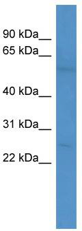 WB Suggested Anti-PDE1A Antibody Titration: 0.2-1 ug/ml; ELISA Titer: 1: 312500; Positive Control: Jurkat cell lysate