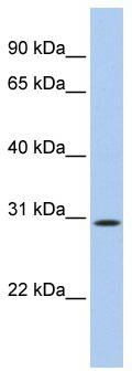 WB Suggested Anti-TP53TG5 Antibody Titration: 0.2-1 ug/ml; Positive Control: 721_B cell lysate