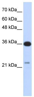 WB Suggested Anti-TP53TG5 Antibody Titration: 0.2-1 ug/ml; ELISA Titer: 1: 1562500; Positive Control: Transfected 293T