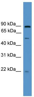 WB Suggested Anti-OAZ3 Antibody Titration: 0.2-1 ug/ml; ELISA Titer: 1: 312500; Positive Control: 293T cell lysate