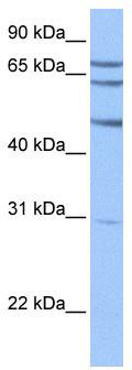 WB Suggested Anti-TSKS Antibody Titration: 1 ug/ml; Positive Control: HepG2 cell lysate