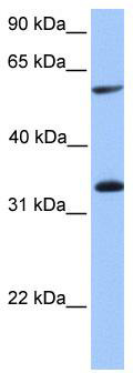 WB Suggested Anti-TSKS Antibody Titration: 0.2-1 ug/ml; Positive Control: Human Placenta