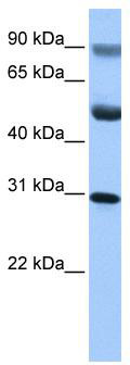 WB Suggested Anti-GID4Antibody Titration: 0.2-1 ug/ml; Positive Control: HepG2 cell lysate