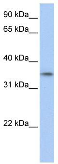 WB Suggested Anti-GID4Antibody Titration: 0.2-1 ug/ml; Positive Control: Human Muscle