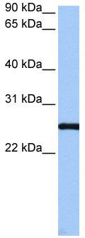 WB Suggested Anti-CEP112 Antibody Titration: 0.2-1 ug/ml; Positive Control: HepG2 cell lysate