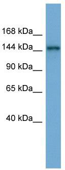 WB Suggested Anti-TEX14 Antibody Titration: 0.2-1 ug/ml; ELISA Titer: 1: 312500; Positive Control: HepG2 cell lysate