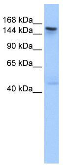WB Suggested Anti-TEX14 Antibody Titration: 0.2-1 ug/ml; Positive Control: Human Muscle