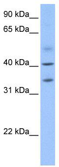 WB Suggested Anti-ZC3H14 Antibody Titration: 0.2-1 ug/ml; Positive Control: Human heart