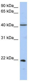 Gel: 10%SDS-PAGE<br>Lysate: 40 μg<br>Lane: Raji cells<br>Primary antibody: TA366745 (ZBP1 Antibody) at dilution 1/1000<br>Secondary antibody: Goat anti rabbit IgG at 1/8000 dilution<br>Exposure time: 40 seconds