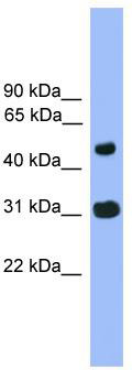 WB Suggested Anti-FAM13C1 Antibody Titration: 0.2-1 ug/ml; ELISA Titer: 1: 312500; Positive Control: Human Lung