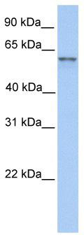 WB Suggested Anti-FAM13C1 Antibody Titration: 0.2-1 ug/ml; Positive Control: Human Liver