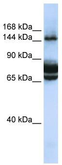 WB Suggested Anti-FAM83B Antibody Titration: 0.2-1 ug/ml; ELISA Titer: 1: 312500; Positive Control: 721_B cell lysate