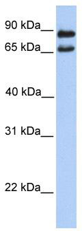 WB Suggested Anti-C9orf117 Antibody Titration: 0.2-1 ug/ml; Positive Control: 721_B cell lysate