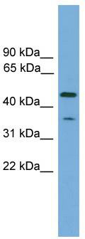 WB Suggested Anti-LRRC73 Antibody Titration: 0.2-1 ug/ml; Positive Control: 293T cell lysate