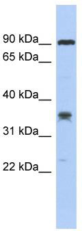 WB Suggested Anti-LRRC73 Antibody Titration: 0.2-1 ug/ml; ELISA Titer: 1: 312500; Positive Control: COLO205 cell lysate