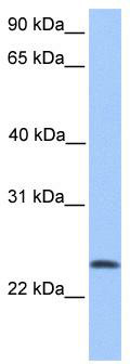 WB Suggested Anti-TCTEX1D4 Antibody Titration: 0.2-1 ug/ml; Positive Control: 721_B cell lysate
