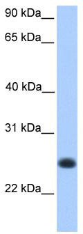 WB Suggested Anti-C12orf68 Antibody Titration: 0.2-1 ug/ml; Positive Control: Human Muscle