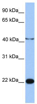 WB Suggested Anti-C2orf68 Antibody Titration: 0.2-1 ug/ml; Positive Control: Jurkat cell lysateC2orf68 is supported by BioGPS gene expression data to be expressed in Jurkat