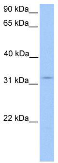 WB Suggested Anti-KCTD21 Antibody Titration: 0.2-1 ug/ml; Positive Control: Human brain