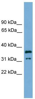 WB Suggested Anti-KCTD21 Antibody Titration: 0.2-1 ug/ml; Positive Control: Jurkat cell lysate