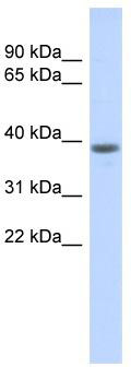 WB Suggested Anti-DCAF4L1 Antibody Titration: 0.2-1 ug/ml; ELISA Titer: 1: 62500; Positive Control: Human Placenta
