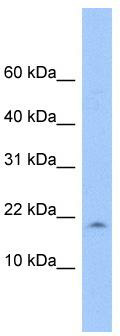 WB Suggested Anti-LOC285033 Antibody Titration: 0.2-1 ug/ml; Positive Control: 721_B cell lysate