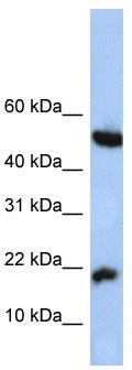 WB Suggested Anti-LOC285033 Antibody Titration: 0.2-1 ug/ml; Positive Control: HepG2 cell lysate
