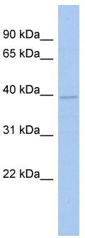 WB Suggested Anti-KLHL35 Antibody Titration: 0.2-1 ug/ml; ELISA Titer: 1: 312500; Positive Control: Human kidney