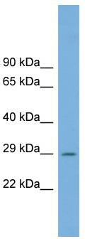 WB Suggested Anti-C1orf43 Antibody Titration: 0.2-1 ug/ml; Positive Control: Human Muscle