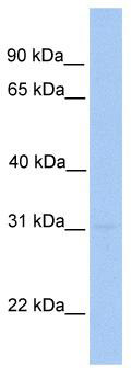 WB Suggested Anti-MMD2 Antibody Titration: 0.2-1 ug/ml; Positive Control: Human brain
