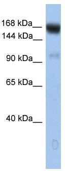 WB Suggested Anti-UBE4B Antibody Titration: 0.2-1 ug/ml; Positive Control: Human brain