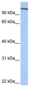 WB Suggested Anti-FES Antibody Titration: 0.2-1 ug/ml; Positive Control: Human Placenta