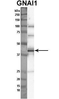 Sample Type: Nthy-ori cell lysate (50 ug); Primary Dilution: 1: 1000; Secondary Antibody: anti-rabbit HRP; Secondary Dilution: 1: 2000; Image Submitted By: Anonymous