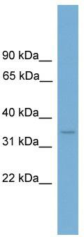 WB Suggested Anti-LUM Antibody Titration: 0.2-1 ug/ml; ELISA Titer: 1: 1562500; Positive Control: Human heart