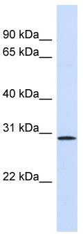 WB Suggested Anti-FGF14 Antibody Titration: 0.2-1 ug/ml; ELISA Titer: 1: 312500; Positive Control: Human Lung