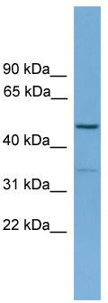 WB Suggested Anti-ARHGAP1 Antibody Titration: 0.2-1 ug/ml; Positive Control: Human Liver