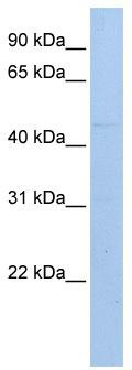 WB Suggested Anti-MAB21L1 Antibody Titration: 0.2-1 ug/ml; ELISA Titer: 1: 12500; Positive Control: 721_B cell lysate