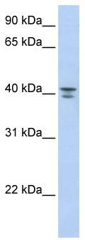 Gel: 8%SDS-PAGE<br>Lysate: 40 μg<br>Lane: Mouse testis tissue lysate<br>Primary antibody: TA364999 (SCP2 Antibody) at dilution 1/350<br>Secondary antibody: Goat anti rabbit IgG at 1/8000 dilution<br>Exposure time: 5 seconds