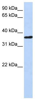 WB Suggested Anti-CHORDC1 Antibody Titration: 0.2-1 ug/ml; ELISA Titer: 1: 62500; Positive Control: Human heart