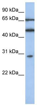 WB Suggested Anti-IFIT5 Antibody Titration: 0.2-1 ug/ml; ELISA Titer: 1: 312500; Positive Control: Jurkat cell lysate