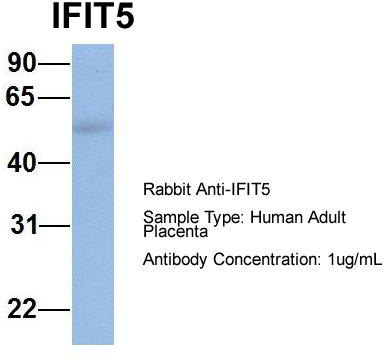 1Hum. Adult Placenta; Host: Rabbit; Target Name: CHAD; Sample Tissue: Human Adult Placenta; Antibody Dilution: 1.0 ug/ml