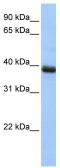 WB Suggested Anti-SPO11 Antibody Titration: 0.2-1 ug/ml; ELISA Titer: 1: 1562500; Positive Control: HepG2 cell lysate