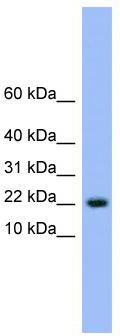 WB Suggested Anti-NXT1 Antibody Titration: 0.2-1 ug/ml; ELISA Titer: 1: 312500; Positive Control: Human Liver