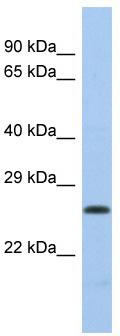 Host: Rabbit; Target Name: POLL; Sample Tissue: MCF7 Whole cell lysates; Antibody Dilution: 1.0 ug/ml