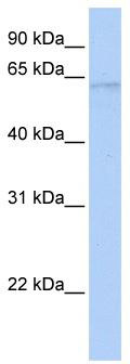 WB Suggested Anti-POLL Antibody Titration: 0.2-1 ug/ml; ELISA Titer: 1: 12500; Positive Control: Human brain