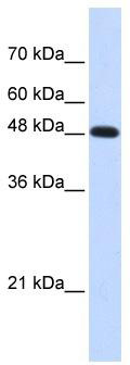 WB Suggested Anti-POLM Antibody Titration: 0.2-1 ug/ml; ELISA Titer: 1: 1562500; Positive Control: Transfected 293T