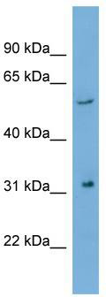 WB Suggested Anti-REM1 Antibody Titration: 0.2-1 ug/ml; Positive Control: Hela cell lysate