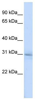 WB Suggested Anti-METTL5 Antibody Titration: 0.2-1 ug/ml; ELISA Titer: 1: 312500; Positive Control: HepG2 cell lysateMETTL5 is supported by BioGPS gene expression data to be expressed in HepG2