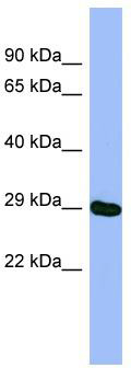 WB Suggested Anti-METTL5 Antibody Titration: 0.2-1 ug/ml; ELISA Titer: 1: 62500; Positive Control: HT1080 cell lysateMETTL5 is supported by BioGPS gene expression data to be expressed in HT1080